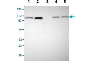 Image no. 4 for anti-Adenylate Kinase 7 (AK7) antibody (ABIN5572259)