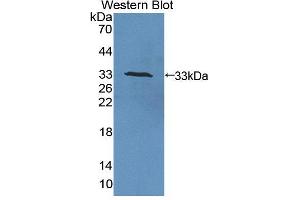 Image no. 3 for anti-Copper Chaperone For Superoxide Dismutase (CCS) (AA 27-268) antibody (ABIN2913328)