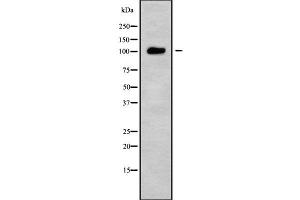 Image no. 1 for anti-Ubiquitin Specific Peptidase 26 (USP26) (C-Term) antibody (ABIN6265918)