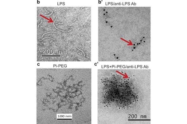 Lipopolysaccharides (LPS) anticorps