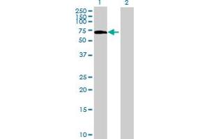 Image no. 1 for anti-Kelch-Like 36 (KLHL36) (AA 1-616) antibody (ABIN529052)