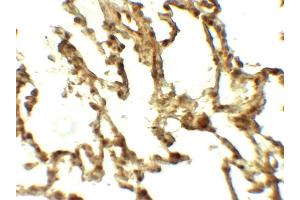 Image no. 3 for anti-Autophagy related 4C Cysteine Peptidase (ATG4C) (C-Term) antibody (ABIN6656912)