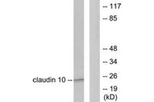 anti-Claudin 10 (CLDN10) (AA 179-228) antibody