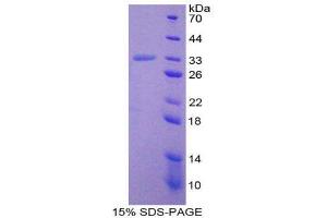 Image no. 1 for Prostaglandin-Endoperoxide Synthase 1 (Prostaglandin G/H Synthase and Cyclooxygenase) (PTGS1) (AA 23-277) protein (His tag) (ABIN1878697)