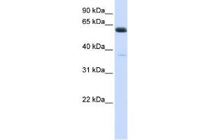 Image no. 1 for anti-Asparagine-Linked Glycosylation 6, alpha-1,3-Glucosyltransferase Homolog (ALG6) (N-Term) antibody (ABIN1449879)