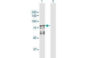 Image no. 3 for anti-Protein S (PROS) (AA 1-676) antibody (ABIN950035)