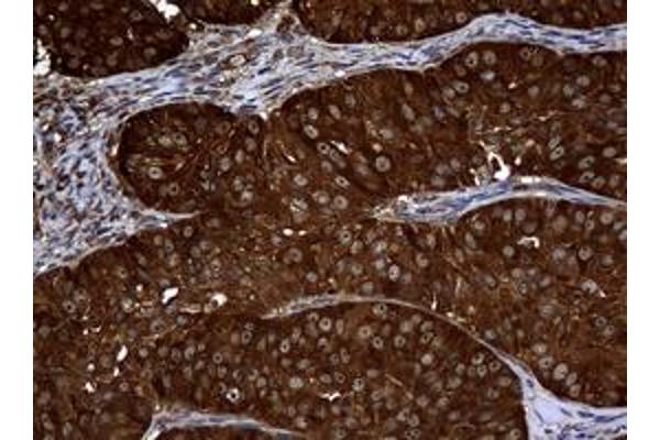 NME1 antibody