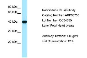 Image no. 2 for anti-Creatine Kinase, Brain (CKB) (C-Term) antibody (ABIN2789613)