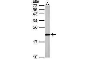 Image no. 3 for anti-ADP-Ribosylation Factor 1 (ARF1) (Center) antibody (ABIN2856896)