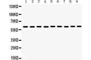 Image no. 2 for anti-Monoamine Oxidase B (MAOB) (AA 448-484), (C-Term) antibody (ABIN3043873)
