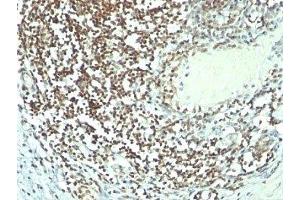 Image no. 1 for anti-Nucleolin (NCL) antibody (ABIN3025715)