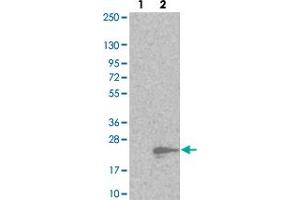 Image no. 2 for anti-Membrane Magnesium Transporter 1 (MMGT1) antibody (ABIN5583619)