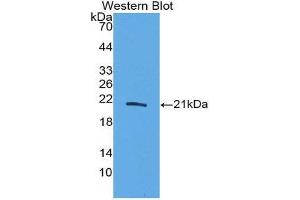 anti-Interleukin 20 (IL20) (AA 25-176) antibody
