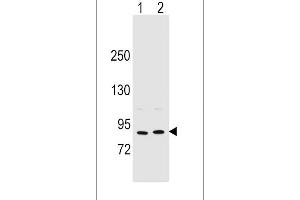 Image no. 1 for anti-Periostin (POSTN) (AA 687-716), (C-Term) antibody (ABIN655902)