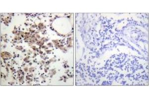 Image no. 1 for anti-Spleen tyrosine Kinase (SYK) (AA 289-338), (pTyr323) antibody (ABIN1531397)