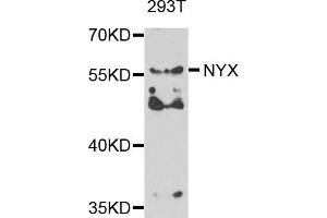 Image no. 1 for anti-Nyctalopin (NYX) antibody (ABIN2737277)