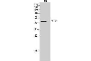 Image no. 1 for anti-Poliovirus Receptor (PVR) (Internal Region) antibody (ABIN3181466)