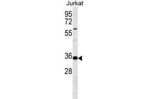 TRNAU1 Antibody (Center) 18294c western blot analysis in Jurkat cell line lysates (35 μg/lane).