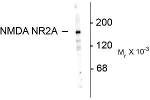 Image no. 1 for anti-Glutamate Receptor, Ionotropic, N-Methyl D-Aspartate 2a (GRIN2A) (N-Term) antibody (ABIN361397)