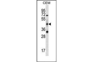 Image no. 2 for anti-RNA Binding Motif Protein 42 (RBM42) (AA 393-422), (C-Term) antibody (ABIN954481)
