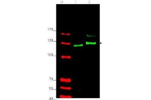 Western blot using  affinity purified anti-Gli-2 antibody shows detection of Gli-2 protein in rat testes (lane 1) and human HEK293 (lane 2) whole cell lysates (arrowhead).