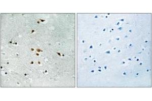 Image no. 2 for anti-FER Tyrosine Kinase (FER) (AA 371-420), (pTyr402) antibody (ABIN1532043)