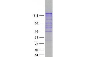 Image no. 1 for Autophagy/beclin-1 Regulator 1 (AMBRA1) protein (Myc-DYKDDDDK Tag) (ABIN2714648)