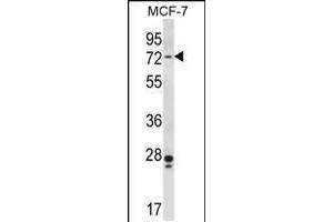 Image no. 1 for anti-P21-Activated Kinase 4 (PAK4) (AA 187-216) antibody (ABIN5534399)
