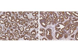 Image no. 2 for anti-CD164 (CD164) (AA 1-162) antibody (ABIN2691600)