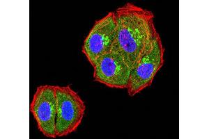 Image no. 1 for anti-Hepatitis A Virus Cellular Receptor 2 (TIM 3) (AA 22-202) antibody (ABIN5611217)