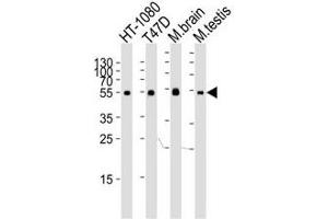 Image no. 2 for anti-Tubulin, alpha 1c (TUBA1C) (N-Term) antibody (ABIN3029335)