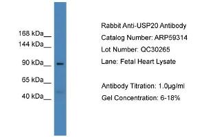 Image no. 2 for anti-Ubiquitin Specific Peptidase 20 (USP20) (Middle Region) antibody (ABIN2788022)