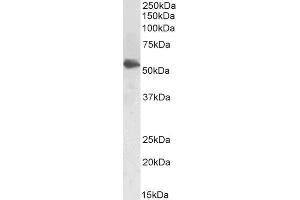 Image no. 2 for anti-Lecithin-Cholesterol Acyltransferase (LCAT) (AA 366-378) antibody (ABIN5539740)
