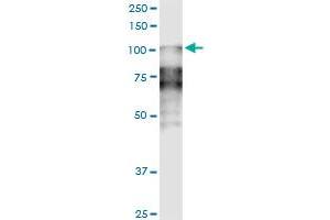 anti-Desmocollin 2 (DSC2) (AA 444-534) antibody