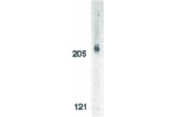 ACIN1 Antikörper  (C-Term)