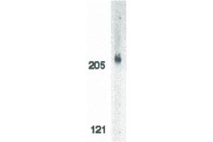 Image no. 2 for anti-Apoptotic Chromatin Condensation Inducer 1 (ACIN1) (C-Term) antibody (ABIN6655072)