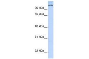 Image no. 1 for anti-Poly (ADP-Ribose) Polymerase Family, Member 9 (PARP9) (AA 144-193) antibody (ABIN6740354)