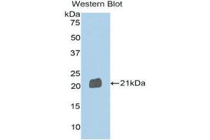Image no. 1 for anti-Sema Domain, Immunoglobulin Domain (Ig), Transmembrane Domain (TM) and Short Cytoplasmic Domain, (Semaphorin) 4B (SEMA4B) (AA 192-367) antibody (ABIN1171799)