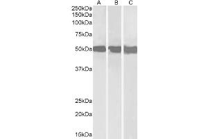 Image no. 2 for anti-DEAD (Asp-Glu-Ala-Asp) Box Polypeptide 6 (DDX6) (C-Term) antibody (ABIN185580)