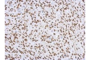 IHC-P Image Immunohistochemical analysis of paraffin-embedded C2C12 xenograft, using Lamin A + C, antibody at 1:500 dilution.