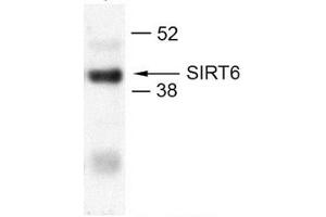 Image no. 2 for anti-Sirtuin 6 (SIRT6) (N-Term) antibody (ABIN2779625)