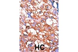 Image no. 2 for anti-V-Erb-A erythroblastic Leukemia Viral Oncogene Homolog 4 (Avian) (ERBB4) (pTyr1162) antibody (ABIN389572)