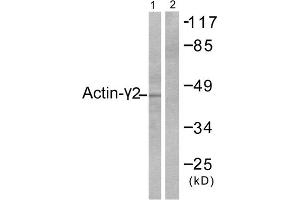 Image no. 3 for anti-Actin, gamma 2, Smooth Muscle, Enteric (ACTG2) (N-Term) antibody (ABIN1848424)
