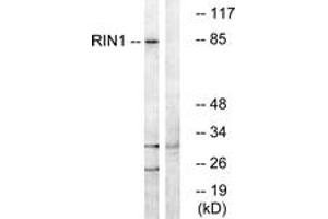 Image no. 1 for anti-Ras and Rab Interactor 1 (RIN1) (AA 655-704) antibody (ABIN1535259)