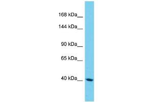 Image no. 1 for anti-Sterile alpha Motif Domain Containing 9-Like (SAMD9L) (N-Term) antibody (ABIN2790581)