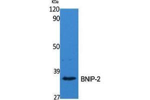 Image no. 2 for anti-BCL2/adenovirus E1B 19kDa Interacting Protein 2 (BNIP2) (Internal Region) antibody (ABIN3183536)