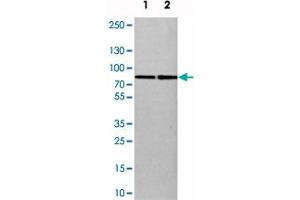 Image no. 2 for anti-SET Domain Containing 3 (SETD3) antibody (ABIN5587780)