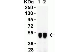 Image no. 2 for anti-SARS-CoV-2 Nucleocapsid (SARS-CoV-2 N) antibody (ABIN6952432)