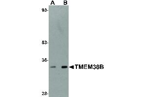 Image no. 1 for anti-Transmembrane Protein 38B (TMEM38B) (C-Term) antibody (ABIN6656410)