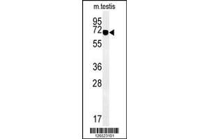 ZBTB5 抗体  (N-Term)